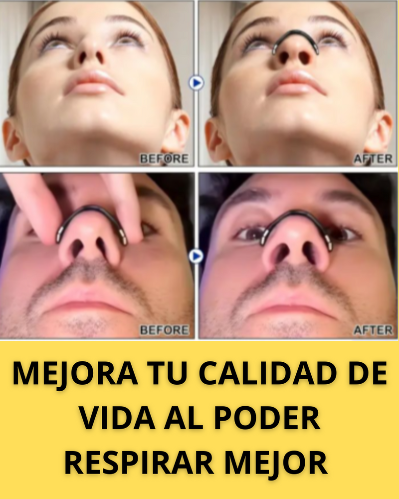 🍃RESPIRA MEJOR Y EVITA PROBLEMAS DE SALUD✅DILATADORES NASALES🚨